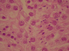 This is a microscopic image of a testicular biopsy specimen